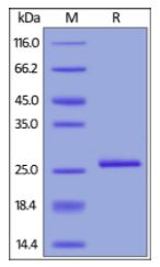 Human C-Reactive Protein, His Tag on SDS-PAGE under reducing (R) condition. The gel was stained overnight with Coomassie Blue. The purity of the protein is greater than 95%.